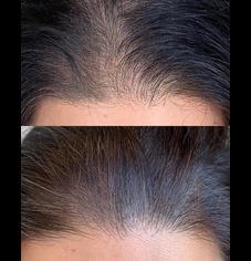 hair-f-new