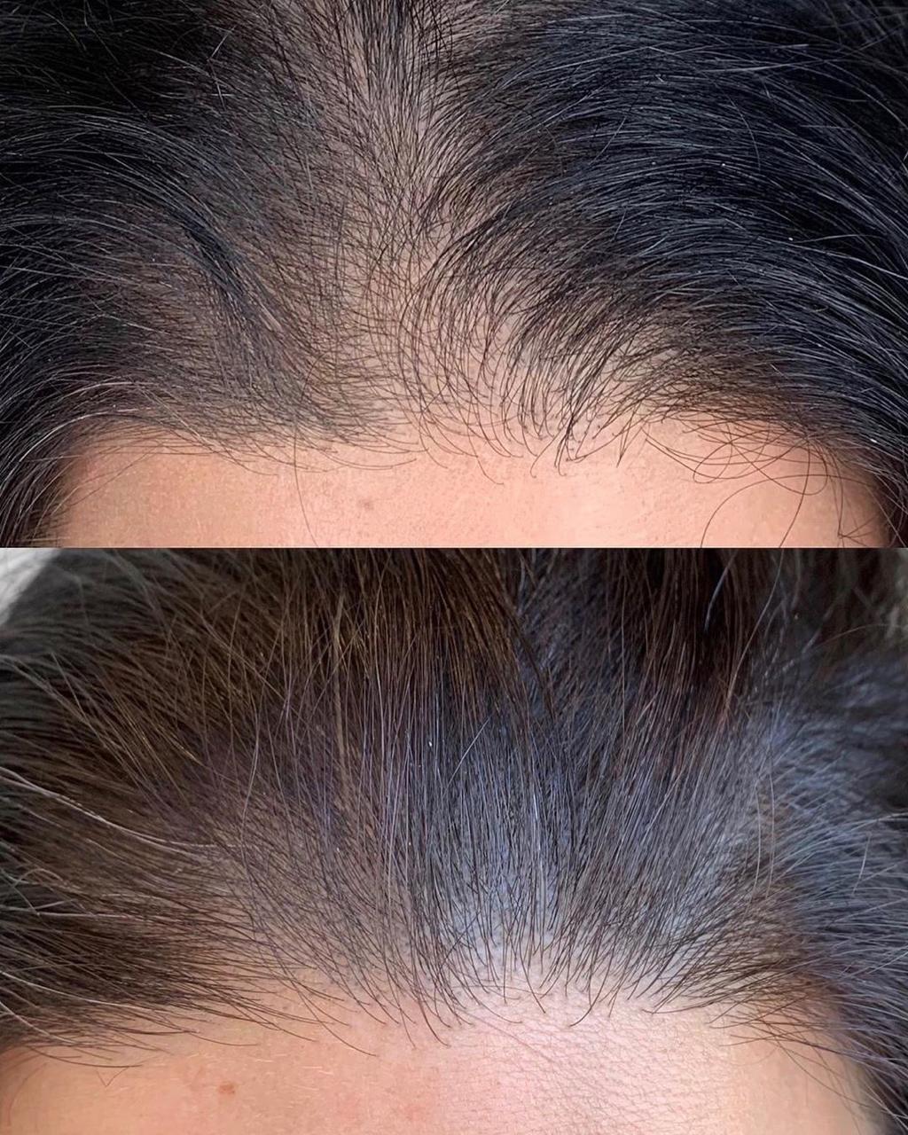 hair-f